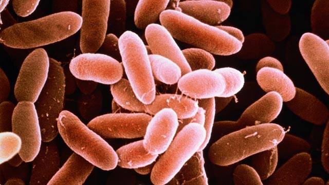 Nhiễm khuẩn Listeria monocytogenes - Hình ảnh minh họa
